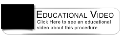 Dental Education Video - Bonding